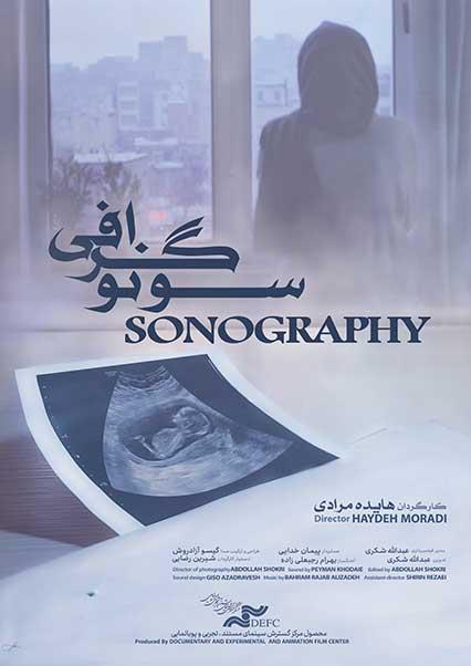 سونوگرافی-هاشور