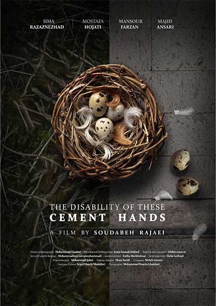 The disability of these cement hands